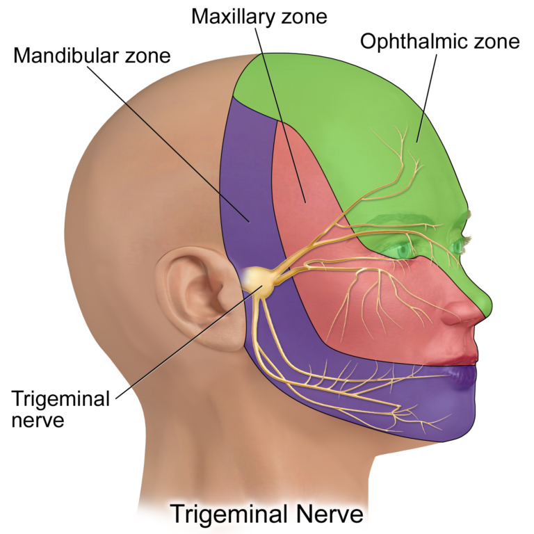 trigeminal-neuralgia-symptoms-trigeminal-neuralgia-treatment