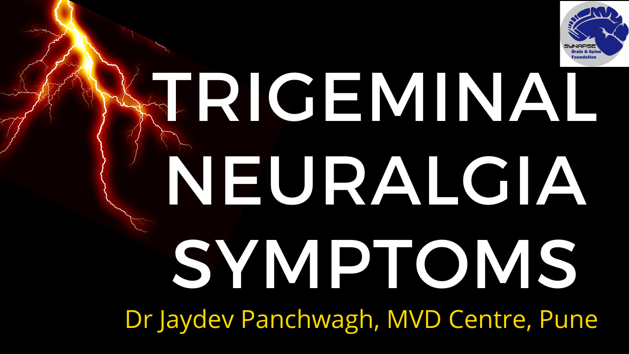 Trigeminal neuralgia symptoms
